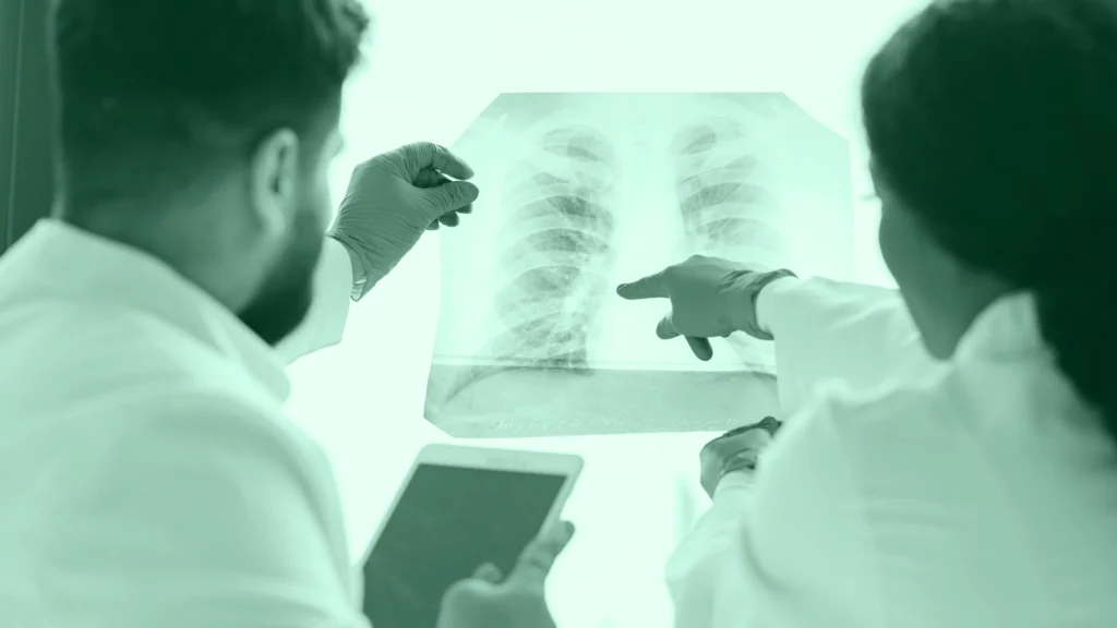 Dos profesionales señalando una radiografía de tórax a contraluz