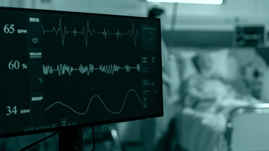 Monitor de signos vitales con electrocardiograma junto a un paciente hospitalizado