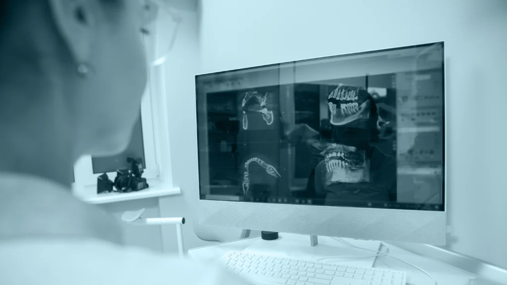 Profesional revisando una tomografía dental en un monitor