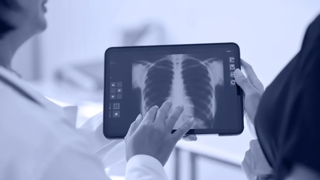 Dos profesionales revisando una radiografía de tórax en una tablet